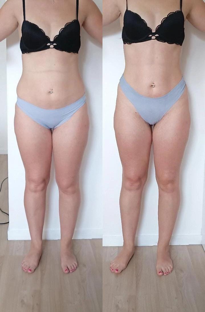 Résultat avant après soin Dianita Massages